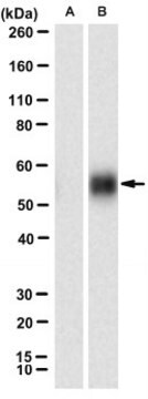 Anti-phospho-PD-1 (Tyr248) Antibody, clone 407.6G12