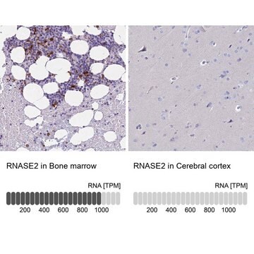 Anti-RNASE2 antibody produced in rabbit Prestige Antibodies&#174; Powered by Atlas Antibodies, affinity isolated antibody, buffered aqueous glycerol solution