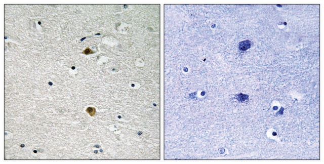 Anti-NF-&#954;B p65 antibody produced in rabbit affinity isolated antibody