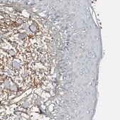 Anti-FN1 antibody produced in rabbit Prestige Antibodies&#174; Powered by Atlas Antibodies, affinity isolated antibody, buffered aqueous glycerol solution