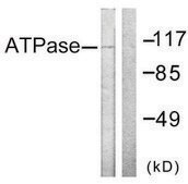 Anti-ATPASE antibody produced in rabbit affinity isolated antibody