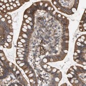 Anti-SGMS2 antibody produced in rabbit Prestige Antibodies&#174; Powered by Atlas Antibodies, affinity isolated antibody, buffered aqueous glycerol solution