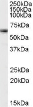 Anti-FOXO4/MLLT7 antibody produced in goat affinity isolated antibody, buffered aqueous solution