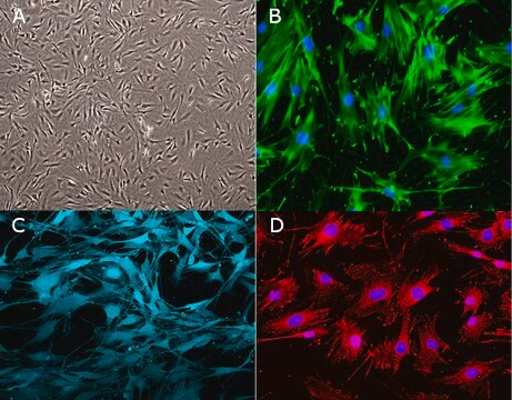 Mouse OP9-DL4-7FS Notch Ligand Cell Line