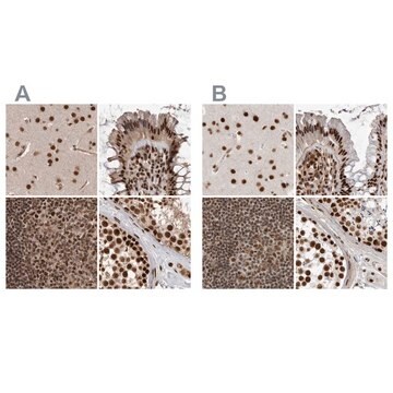 Anti-PPP1R8 antibody produced in rabbit Prestige Antibodies&#174; Powered by Atlas Antibodies, affinity isolated antibody, buffered aqueous glycerol solution, Ab3