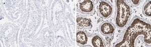 Anti-GAPDH Antibody, clone 10B13, ZooMAb&#174; Rabbit Monoclonal recombinant, expressed in HEK 293 cells