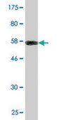 Monoclonal Anti-COL2A1 antibody produced in mouse clone 1E1, purified immunoglobulin, buffered aqueous solution