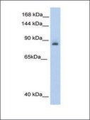 Anti-ACO1 antibody produced in rabbit affinity isolated antibody