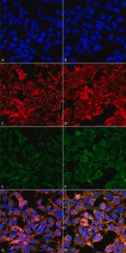 Monoclonal Anti-Malondialdehyde antibody produced in mouse clone 11E3