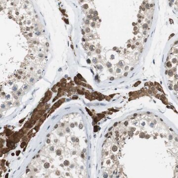 Anti-NEK4 antibody produced in rabbit Prestige Antibodies&#174; Powered by Atlas Antibodies, affinity isolated antibody, buffered aqueous glycerol solution