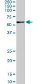 ANTI-RARA antibody produced in mouse clone 1C10, purified immunoglobulin, buffered aqueous solution