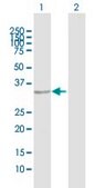 Anti-TNNT1 antibody produced in rabbit purified immunoglobulin, buffered aqueous solution