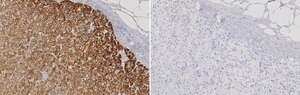 Anti-CYP11A1 Antibody, clone 2M5 ZooMAb&#174; Rabbit Monoclonal recombinant, expressed in HEK 293 cells
