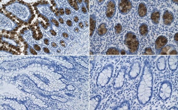 Anti-PALS1 Antibody, clone 3F20 ZooMAb&#174; Rabbit Monoclonal recombinant, expressed in HEK 293 cells