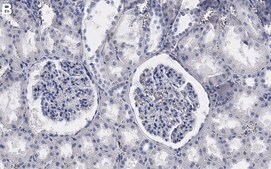 Anti-SLC12A3 Antibody, clone 3I12 ZooMAb&#174; Rabbit Monoclonal recombinant, expressed in HEK 293 cells