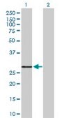 Anti-PRSS2 antibody produced in rabbit purified immunoglobulin, buffered aqueous solution