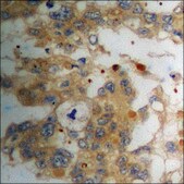 Anti-phospho-PLD1 (pSer561) antibody produced in rabbit affinity isolated antibody