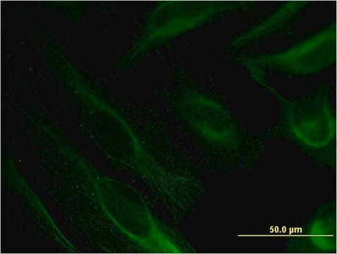 Monoclonal Anti-BST2 antibody produced in mouse clone 2E6, purified immunoglobulin, buffered aqueous solution