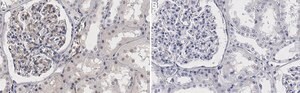 Anti-VEGFR-2 Antibody, clone 3C21 ZooMAb&#174; Rabbit Monoclonal recombinant, expressed in HEK 293 cells