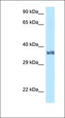 Anti-LUM antibody produced in rabbit affinity isolated antibody