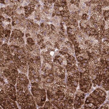 Anti-LIMS1 antibody produced in rabbit Prestige Antibodies&#174; Powered by Atlas Antibodies, affinity isolated antibody