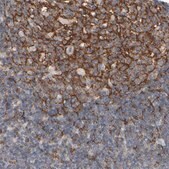 Anti-EPHX2 antibody produced in rabbit Prestige Antibodies&#174; Powered by Atlas Antibodies, affinity isolated antibody, buffered aqueous glycerol solution, Ab1