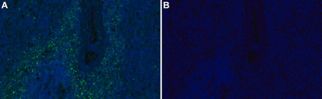 Anti-PAFAH/PLA2G7 Antibody, clone 1E9 ZooMAb&#174; Rabbit Monoclonal recombinant, expressed in HEK 293 cells