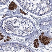 Anti-CYP51A1 antibody produced in rabbit Prestige Antibodies&#174; Powered by Atlas Antibodies, affinity isolated antibody, buffered aqueous glycerol solution