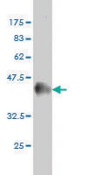 Monoclonal Anti-MCC antibody produced in mouse clone 1A7, purified immunoglobulin, buffered aqueous solution