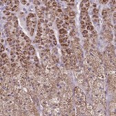 Anti-CYP11B2 antibody produced in rabbit Prestige Antibodies&#174; Powered by Atlas Antibodies, affinity isolated antibody, buffered aqueous glycerol solution