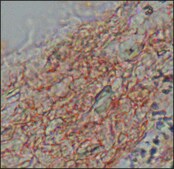 Anti-Fibroblast Growth Factor Receptor-2, Extracellular antibody produced in rabbit affinity isolated antibody, buffered aqueous solution