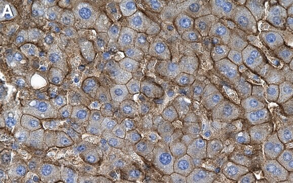 Anti-SLC13A5 Antibody, clone 1D4 ZooMAb&#174; Rabbit Monoclonal recombinant, expressed in HEK 293 cells