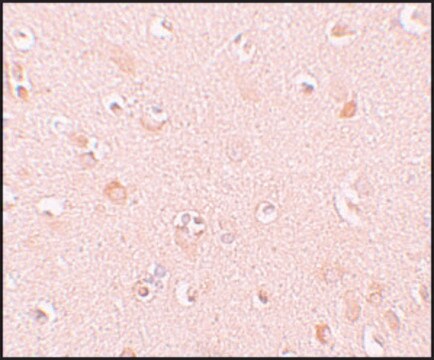 Anti-NALP5 antibody produced in rabbit affinity isolated antibody, buffered aqueous solution