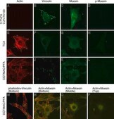 Monoclonal Anti-&#946;-Actin antibody produced in mouse clone AC-15, ascites fluid