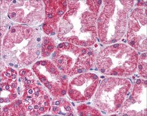 Anti-STAT3 antibody produced in rabbit affinity isolated antibody