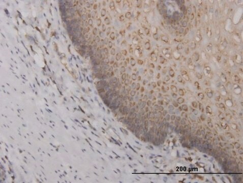 Monoclonal Anti-RPS2 antibody produced in mouse clone 3G6, purified immunoglobulin, buffered aqueous solution