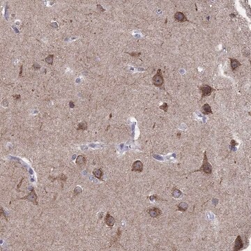 Anti-LMTK3 Prestige Antibodies&#174; Powered by Atlas Antibodies, affinity isolated antibody