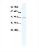 Anti-GABRA3 (AB1) antibody produced in rabbit IgG fraction of antiserum