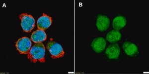 Anti-p57Kip2 Antibody, clone 1H11 ZooMAb&#174; Rabbit Monoclonal recombinant, expressed in HEK 293 cells