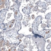 Monoclonal Anti-AFP antibody produced in mouse Prestige Antibodies&#174; Powered by Atlas Antibodies, clone CL9766, purified immunoglobulin, buffered aqueous glycerol solution