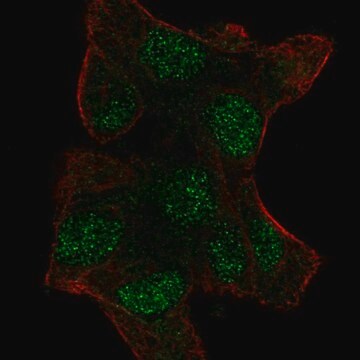 Anti-UBE2V1 antibody produced in rabbit Prestige Antibodies&#174; Powered by Atlas Antibodies, affinity isolated antibody