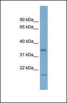 Anti-IGFBP2 antibody produced in rabbit affinity isolated antibody