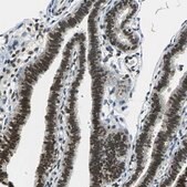 Anti-RBM14 antibody produced in rabbit Prestige Antibodies&#174; Powered by Atlas Antibodies, affinity isolated antibody, buffered aqueous glycerol solution