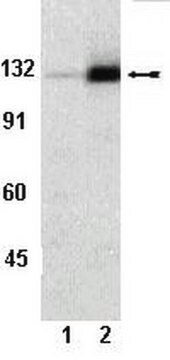 Anti-phospho-FAK (Tyr861) Antibody Upstate&#174;, from rabbit