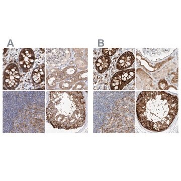 Anti-CARMIL1 antibody produced in rabbit Prestige Antibodies&#174; Powered by Atlas Antibodies, affinity isolated antibody, buffered aqueous glycerol solution, ab1