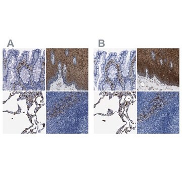 Anti-ANXA1 antibody produced in rabbit Prestige Antibodies&#174; Powered by Atlas Antibodies, affinity isolated antibody, buffered aqueous glycerol solution