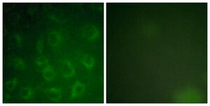 Anti-PDGFR &#946; antibody produced in rabbit affinity isolated antibody