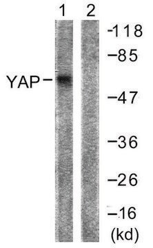 Anti-YAP antibody produced in rabbit affinity isolated antibody