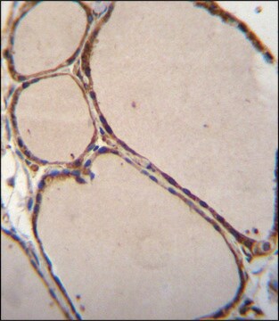 ANTI-NFKBID (N-TERM) antibody produced in rabbit IgG fraction of antiserum, buffered aqueous solution
