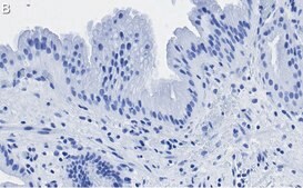 Anti-Nrf2 Antibody, clone 5B20 ZooMAb&#174; Rabbit Monoclonal recombinant, expressed in HEK 293 cells